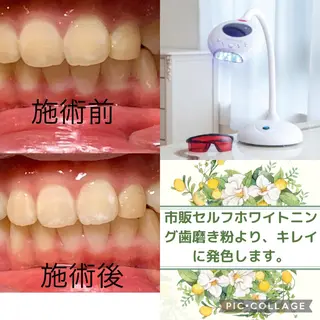 整体フェイシャル EMINALのエステ・リラクイメージ