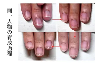 ネイル 深爪矯正・自爪育成 ヴェールリムのネイルデザイン