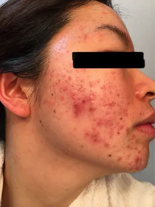 毛穴美人・小顔美人へ サロントルチュのエステ・リラクイメージ