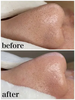 マツエク・マツパ 韓国肌管理 【毛穴専科】のエステ・リラクイメージ