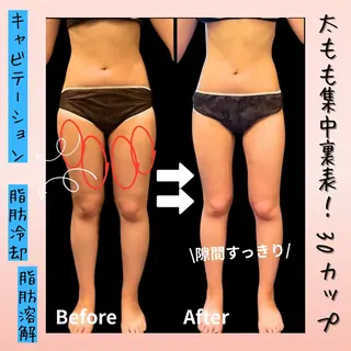 Tipani beaute'所属・Tipani beaute'のエステ・リラクイメージ