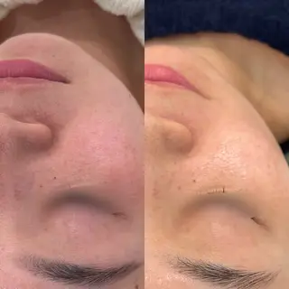 〈etre〉トータルビューティーサロン所属・etre - 韓国肌管理 -のエステ・リラクイメージ