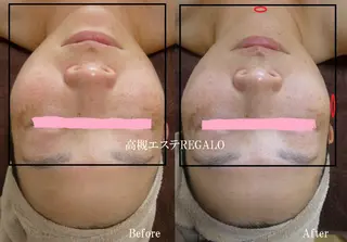 REGALO所属・矢野 さやかのエステ・リラクイメージ