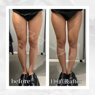 部分痩せ♥️小顔専門 MIKUのエステ・リラクイメージ