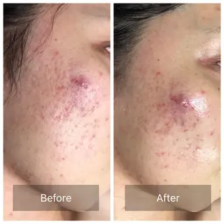 Radiance H.Oのエステ・リラクイメージ