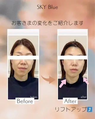 SKY Blueのエステ・リラクイメージ