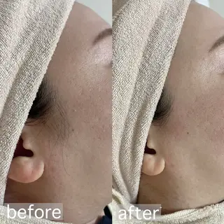 アイブロウ&フェイシャルサロンa‘lm所属・WAX脱毛/肌質改善 眉毛とお肌のサロンのエステ・リラクイメージ