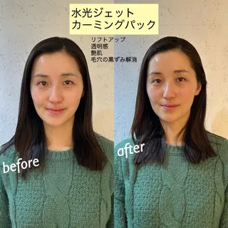 うなじ脱毛/美肌脱毛 LABELのエステ・リラクイメージ