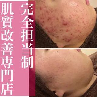 ミディアム カラー パーマ ヘアアレンジ メンズ キッズ ネイル マツエク・マツパ ニキビ・肌質改善専門 ♡人生が変わるサロンのエステ・リラクイメージ