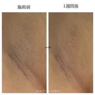 ビューティー ミロワールのエステ・リラクイメージ