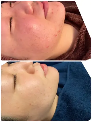 Lei beauty salon所属・松ヤニワックス専門/ 梅田/Leiのエステ・リラクイメージ