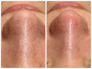 mumu beautyのエステ・リラクイメージ