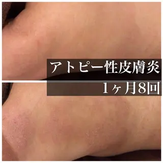 ミディアム カラー パーマ ヘアアレンジ メンズ キッズ ネイル マツエク・マツパ ニキビ・肌質改善専門 ♡人生が変わるサロンのエステ・リラクイメージ