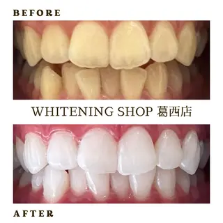 メンズ ホワイトニング ショップ葛西店のその他イメージ