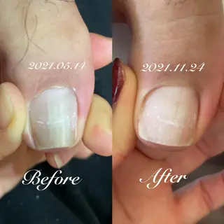 ネイル roconail ヒロコのネイルデザイン