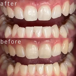 サクッとホワイト都立大学店所属・セルフホワイトニング 都立大学🦷✴︎のその他イメージ