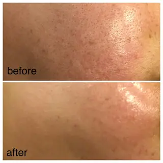 カラー SALON SINCERITEのエステ・リラクイメージ