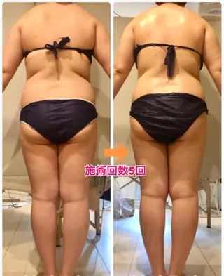 ロング カラー パーマ ヘアアレンジ メンズ キッズ ネイル マツエク・マツパ ‍痩身＆ボディ 結果出し🌟丹野のエステ・リラクイメージ