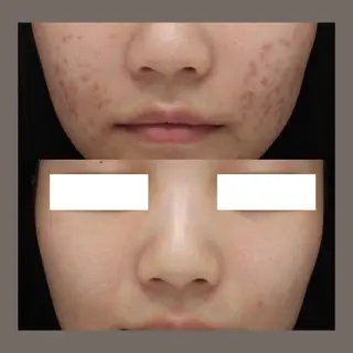 マツエク・マツパ 愛維美水光美肌専門店所属・愛維美水光美肌専門店 メンズレディースokのエステ・リラクイメージ