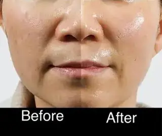 最速小顔・肌質管理 espoirマキのエステ・リラクイメージ