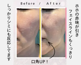 パーソナルビューティ アイリー所属・パーソナルサロン iley【アイリー】のエステ・リラクイメージ