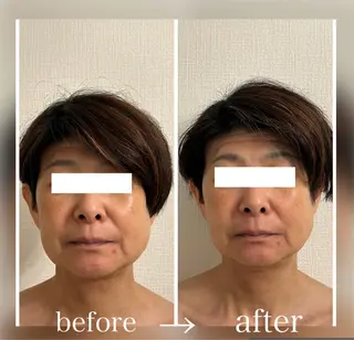 小顔セラピーLIL所属・小顔セラピー LILのエステ・リラクイメージ