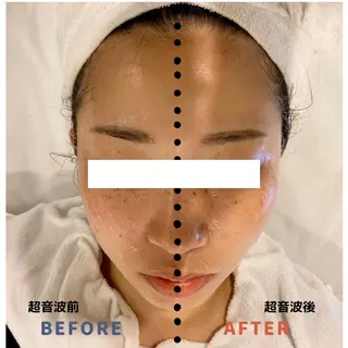 エステと焼き菓子 レモンバームソワンのエステ・リラクイメージ