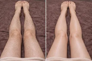 脱毛×肌管理サロン ルネルのエステ・リラクイメージ