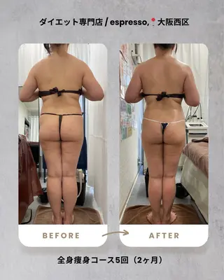 espresso,所属・《痩身、小顔専門店》 エスプレッソのエステ・リラクイメージ