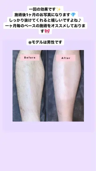 セミロング カラー パーマ ヘアアレンジ メンズ キッズ ネイル マツエク・マツパ Chloe-クロエ- 脱毛/フェイシャルのエステ・リラクイメージ