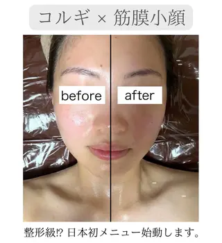 biloop所属・《本気痩せ×疲労改善 》  BILOOPのエステ・リラクイメージ