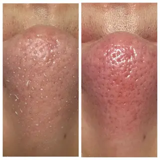 メンズ LUCIALL  ルシアル所属・児玉 愛由美のエステ・リラクイメージ