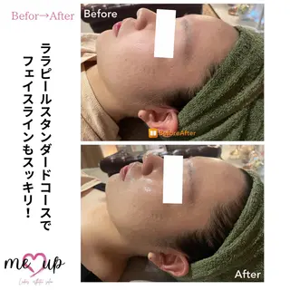 Meupニキビ専門店 背中/ハーブ/肌管理のその他イメージ