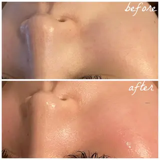 メンズ メナード岐阜市茜部 杉浦のエステ・リラクイメージ