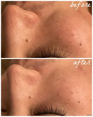 メンズ メナード岐阜市茜部 杉浦のエステ・リラクイメージ