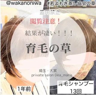 private salon  Dea_maris シュガーリング＆パーソナルボディケア所属・シミ改善・韓国肌管理 ボディメイク痩身のその他イメージ