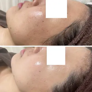 肌質改善サロン La Divinaのエステ・リラクイメージ