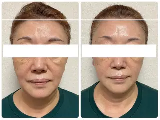 KalanDiva〜 ｶﾗﾝﾃﾞｨｰﾊﾞ〜のエステ・リラクイメージ