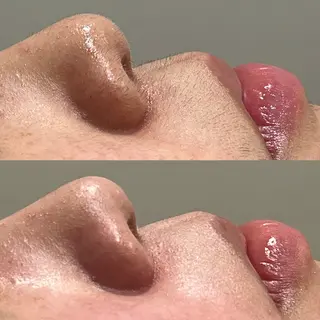 LICO_NEE_所属・LICO_NEE_ yukikoのエステ・リラクイメージ