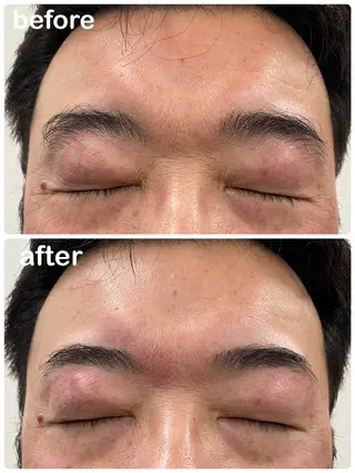 メンズ アイブロウ Mubye所属・Yamagtchi hinaのエステ・リラクイメージ