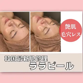 韓国肌管理専門店　White labo 新潟店所属・韓国肌管理専門店 Rihoのエステ・リラクイメージ