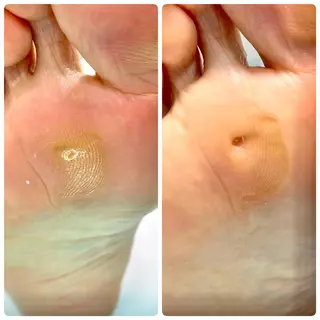 東京巻き爪アカデミー所属・東京巻き爪 アカデミーのエステ・リラクイメージ