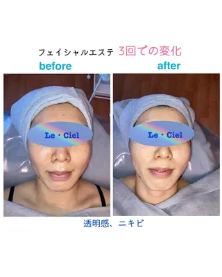フェイシャルエステLe・Ciel所属・Le・Ciel フェイシャル&ボディのエステ・リラクイメージ
