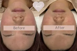 べアール所属・小顔/毛穴/ニキビ salon bealのエステ・リラクイメージ