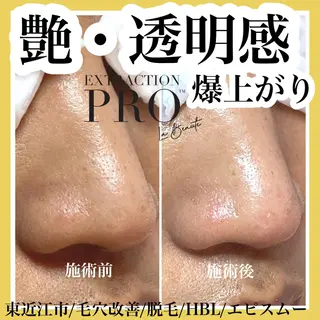 epismoo 脱毛/HBL/毛穴の眉毛・アイブロウイメージ