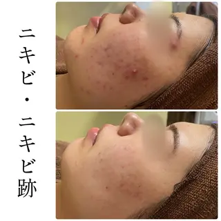 ハーブピーリング専門 BIOEL横浜のエステ・リラクイメージ