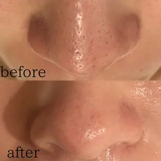 Amm所属・🏆艶肌ワックス🏆 ララピール✨Ammのエステ・リラクイメージ