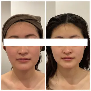 通うほど変わる本格 エステ心斎橋REVIのエステ・リラクイメージ