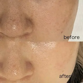 skinity所属・ピーリング専門サロン skinityのエステ・リラクイメージ