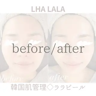 For...天王寺店 リンパ|ヘッドよもぎのエステ・リラクイメージ